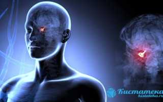 Признаки и методы лечения аденомы гипофиза головного мозга