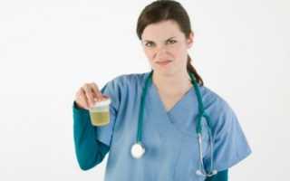 Запах аммиака в моче у женщин: причины, диагностика и лечение