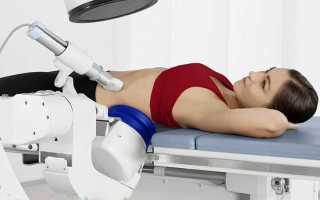 От чего образуются камни в почках: основные причины