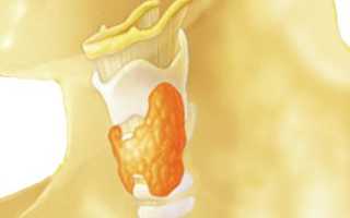 Эндемический зоб : причины, симптомы, диагностика, лечение, профилактика