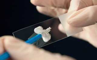 Эпителий плоский в урологическом мазке