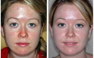 Идеальный мультипилинг Gigi — доступная роскошь для шикарной кожи