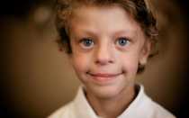 Синдром Вильямса – признаки и прогноз жизни детей-эльфов