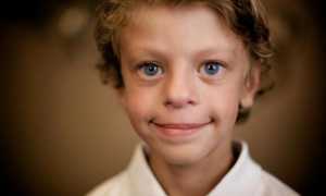 Синдром Вильямса – признаки и прогноз жизни детей-эльфов