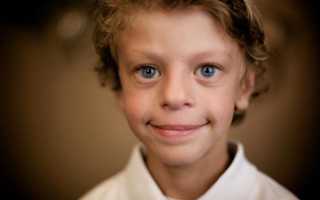 Синдром Вильямса – признаки и прогноз жизни детей-эльфов