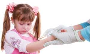 Что делать, если Манту покраснела в первый или во второй день?