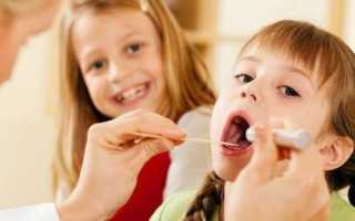 Лечение назофарингита: полоскания, ингаляции, профилактика