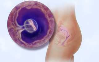 2 недели беременности от зачатия. Признаки и ощущения, что происходит, фото плода