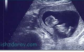 12 неделя беременности: ощущения, размер плода, пол