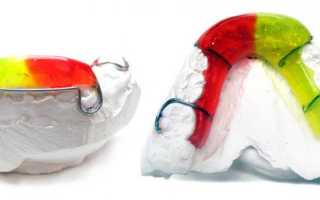 Ортодонтический аппарат Брюкля для коррекции прикуса