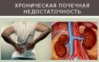 Что такое хпн 3