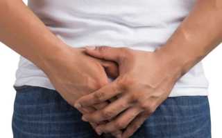 Баланопостит – как проявляется и чем опасно заболевание у ребенка?