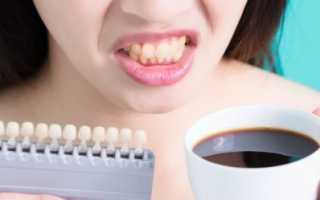 Пигментация зубов и налеты причины принципы лечения профилактика