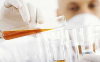 Плохой анализ мочи у мужчины причины