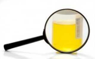 Почему моча темно желтого цвета у женщин — Почки