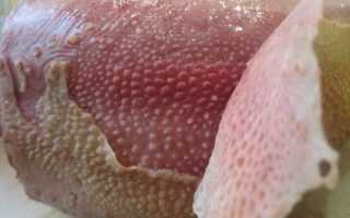 Белые точки на языке: почему возникают и как лечить