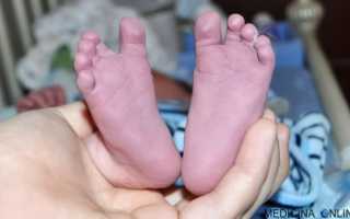 Здоровье и здоровый образ жизниЦианоз губ что это такое фото