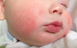 Сироп стоптуссин-фито инструкция по применению для детей и взрослых, аналоги, состав, отзывы