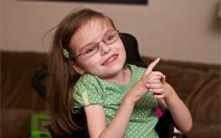 Признаки синдрома Ретта, лечение, прогноз и диагностика