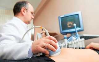 Что такое ДГПЖ 2 степени: симптомы и лечение