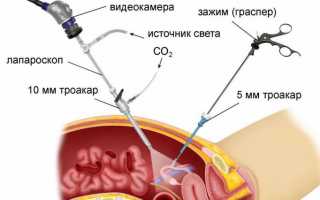 Повышенная подвижность правой почки патологическая