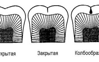 Что может вызвать развитие и прогрессирование кариеса?