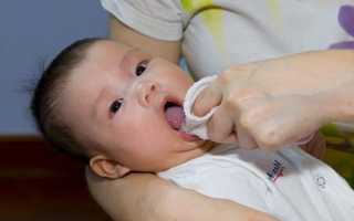 Возможные причины белого налёта на языке и 3 способа его очистки у грудных детей