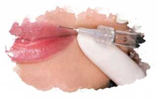 ТОП-7 лучших филлеров для губ: рейтинг 2020, как выбрать, плюсы и минусы, отзывы