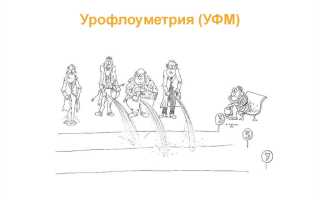 Семиотика и методы диагностики в урологии