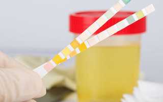 Алгоритм сбора суточного анализа мочи на сахар