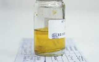 Общий анализ мочи. Нормы общего анализа мочи. Общий анализ мочи, расшифровка. Нормы мочи у взрослых, женщин и мужчин. Норма мочи у детей.