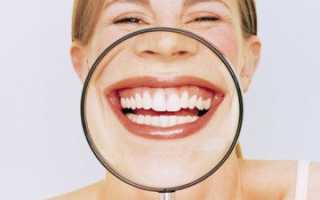 Причины появления белых пятен на деснах у взрослых и детей