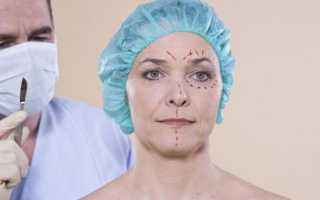 Фейслифтинг для лица – упражнения, операция, подтяжка