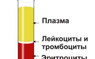 Общий анализ крови (клинический): нормы, расшифровка, таблица