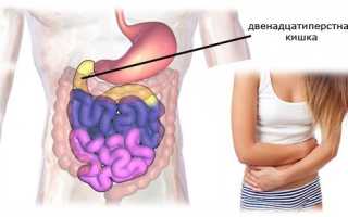 Дуоденит — эффективные методы лечения распространённого заболевания