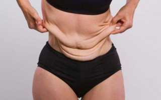 Как избавиться от обвисшей кожи: боремся с недостатками изнутри и снаружи