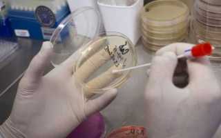 Гемотест урологический мазок на флору