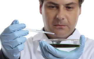 Как берется урологический мазок у мужчин