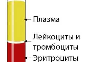 Повышенный гематокрит у женщин: причины и последствия