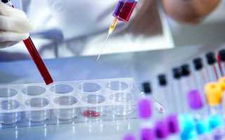 Гематолог — кто это, при каких симптомах и заболеваниях нужно записаться на консультацию к врачу