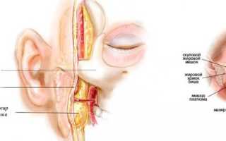 Комки Биша – что это такое и как от них избавиться?