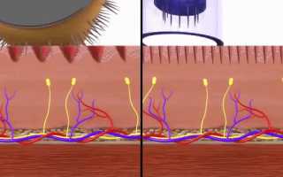 Звездочки мои… сосудистые (Лечение купероза лазером: до и после)