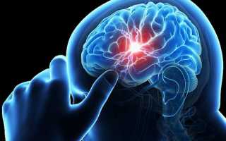 Цистит лечение после инсульта — Последствия инсульта