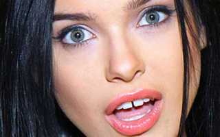 Закрытие центральной диастемы техникой послойного нанесения композита