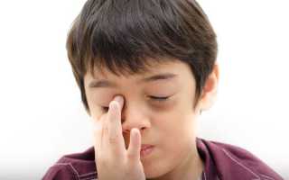 Отёки, мешки и синяки под глазами ребёнка. Что делать родителям?