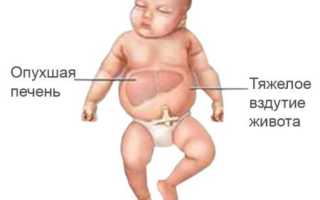 Зачем проводят анализ крови на антитела при беременности?