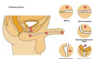 Жжение в уретре после мочеиспускания у мужчин: причины, как лечить
