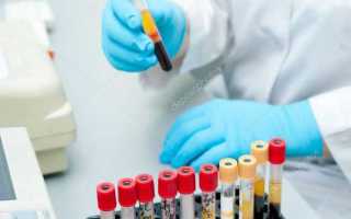 Здать анализы по урологии