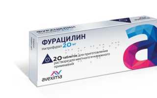 Когда сильно болят язвочки во рту — это стоматит у детей. Лечение в домашних условиях, быстро и надёжно