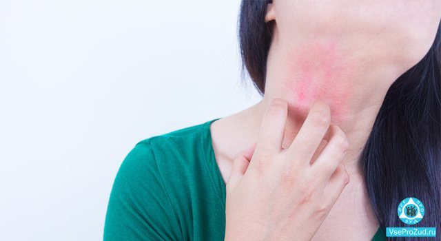 Аллергия на коже в виде красных пятен. Лечение на руках, ногах, шее у взрослых и детей, если чешутся
